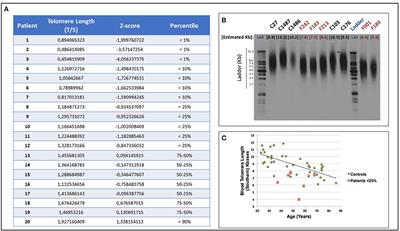 Lung Transplant Improves Survival and Quality of Life Regardless of Telomere Dysfunction